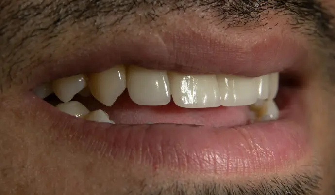 a close up of a person's mouth