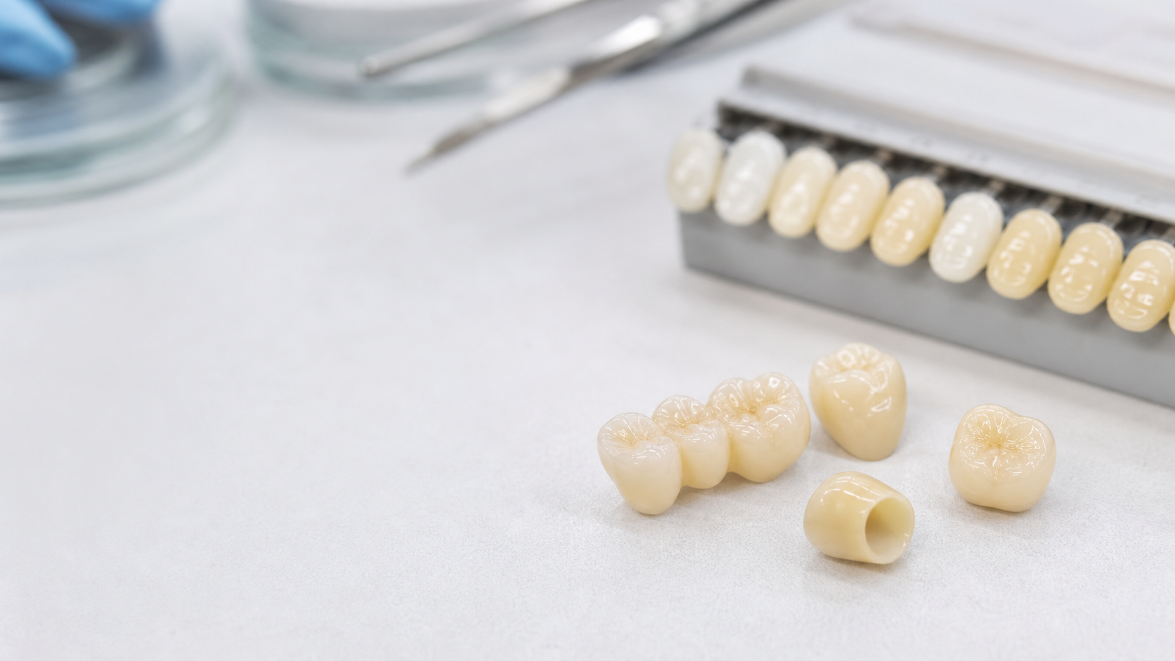 How to Choose a Dental Crown: Material, Function, and Appearance