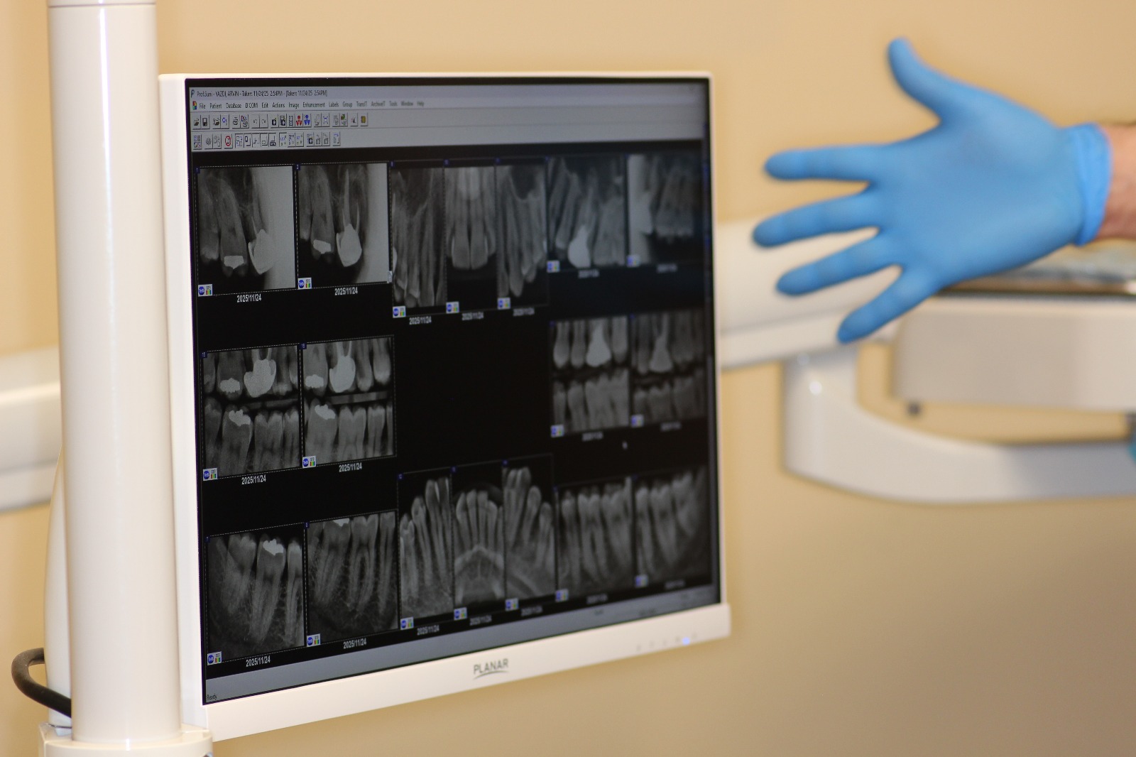 Dental X-ray used to evaluate the roots and surrounding bone