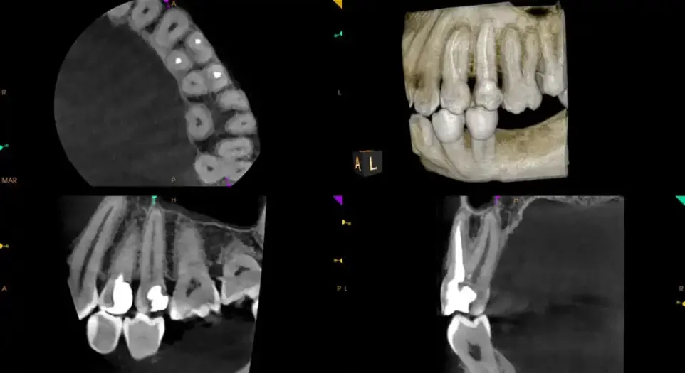 dental X-ray image