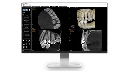 dental X-ray image  in Orange County