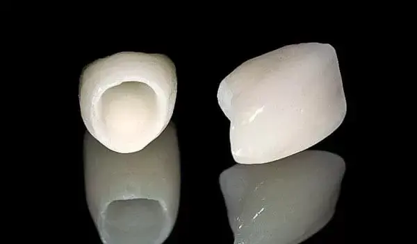PORCELAIN-FUSED-TO-ZIRCONIA