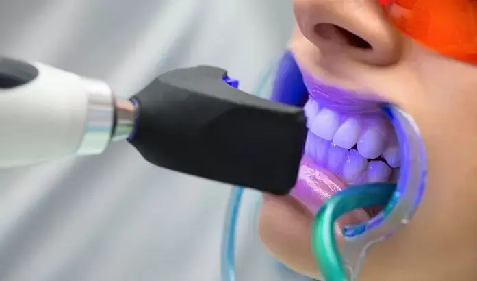 How Does Teeth Whitening Work