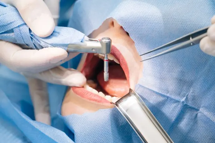 Patient Receiving implant in orange County